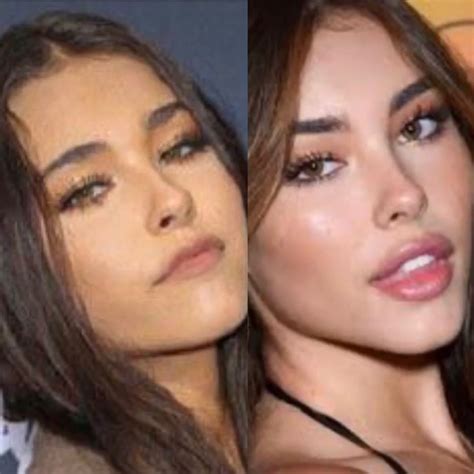 madison beer plastic sugery|Madison Beer Denies Plastic Surgery Rumors After。